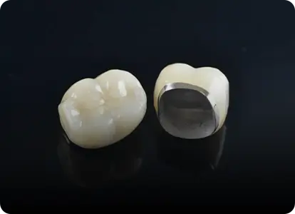 Металлокерамические коронки