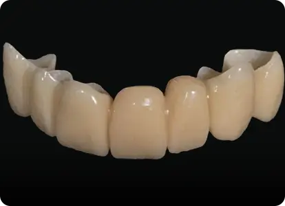 Временные коронки